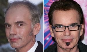 Billy Bob Thornton hair transplant