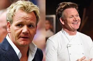 Gordon Ramsay Hair transplant