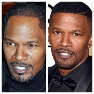 Jamie Foxx Hair transplant