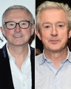 Louis Walsh Hair transplant