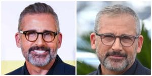 Steve Carell Hair transplant