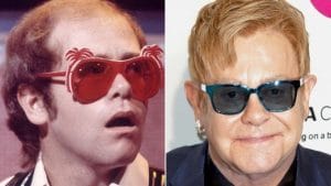 Elton John hair transplant