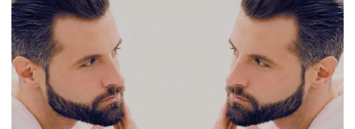 Beard Transplant Aftercare Guide