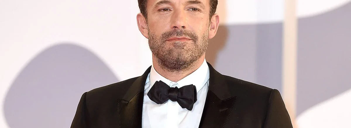 Ben Affleck Hair Transplant