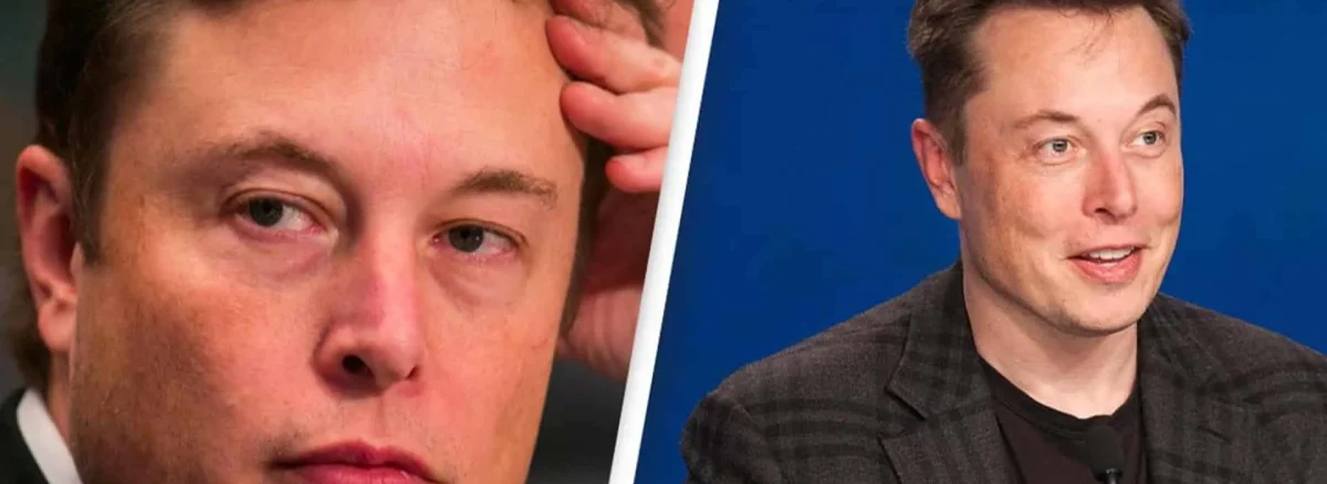 Elon Musk Hair Transplant