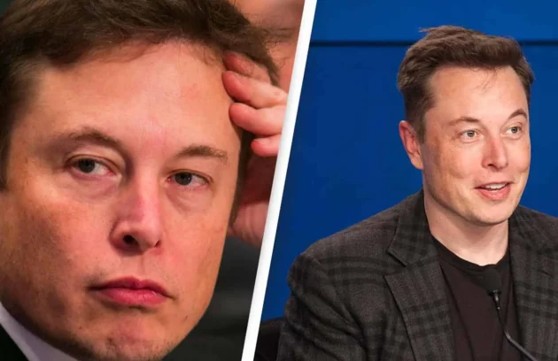Elon Musk Hair Transplant