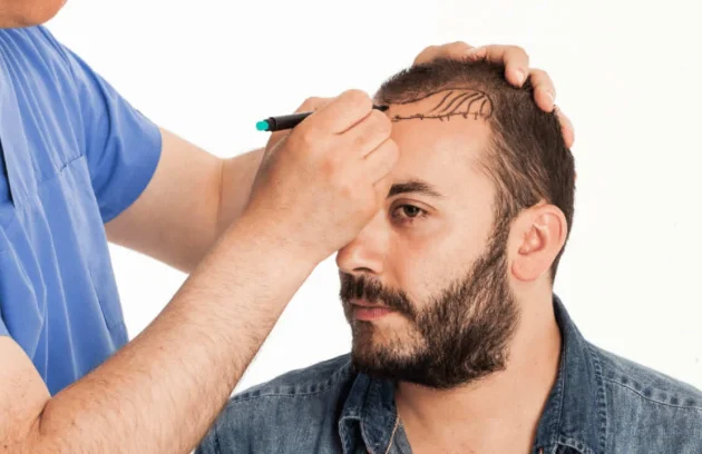 Turkey Hair Transplant Packages