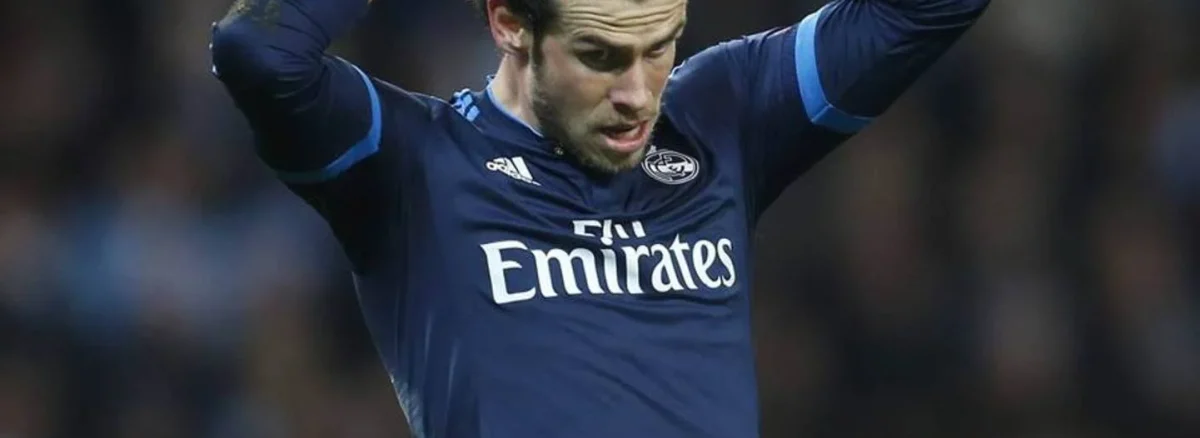 Gareth Bale Hair Transplant