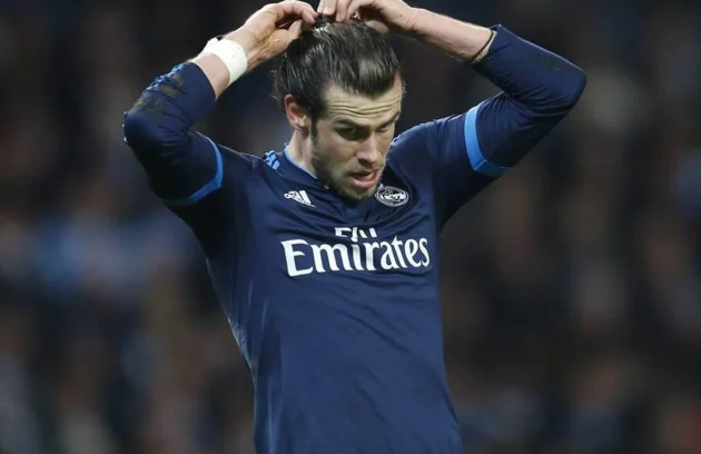 Gareth Bale Hair Transplant