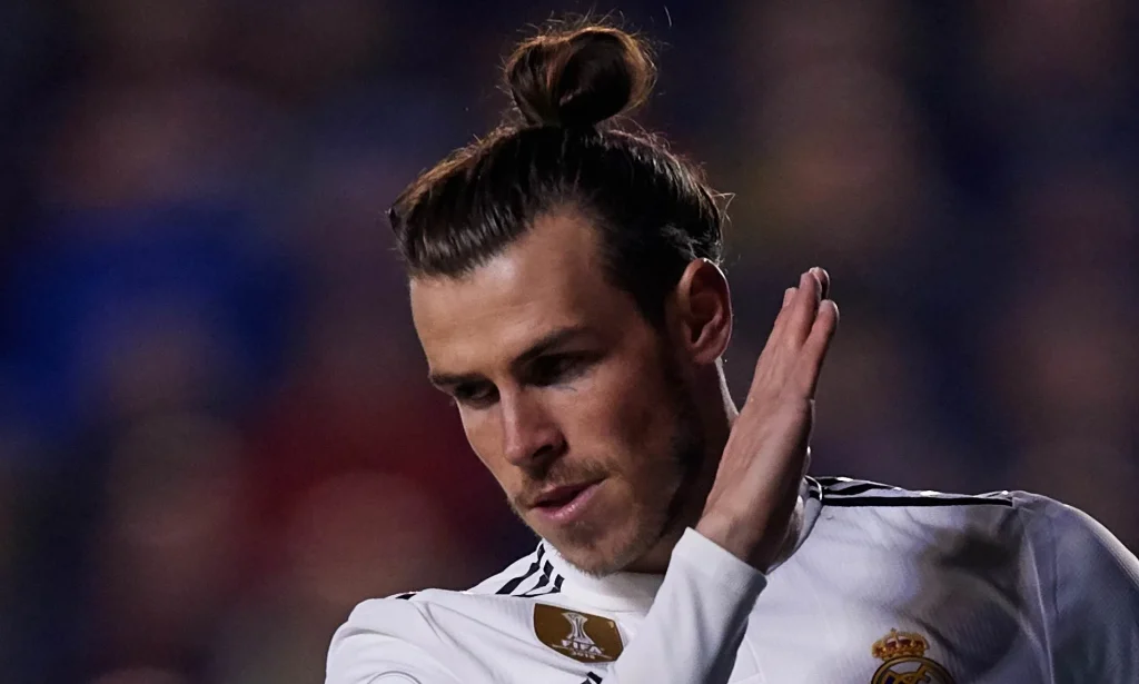 Gareth Bale Hair Transplant