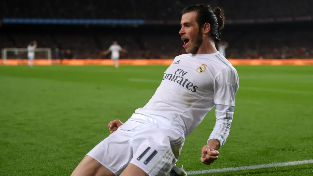 Gareth Bale Hair Transplant