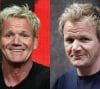 Gordon Ramsay Hair Transplant