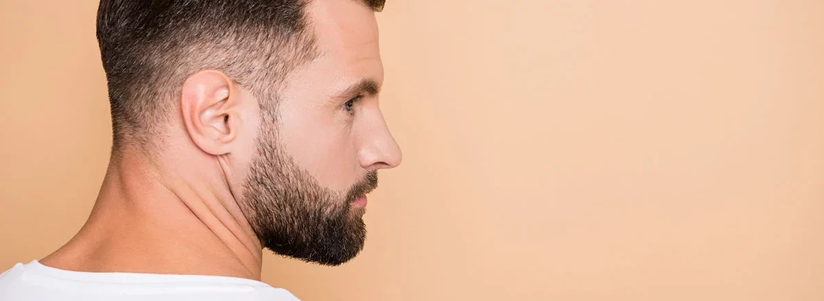 What is Organic Hair Transplantation?