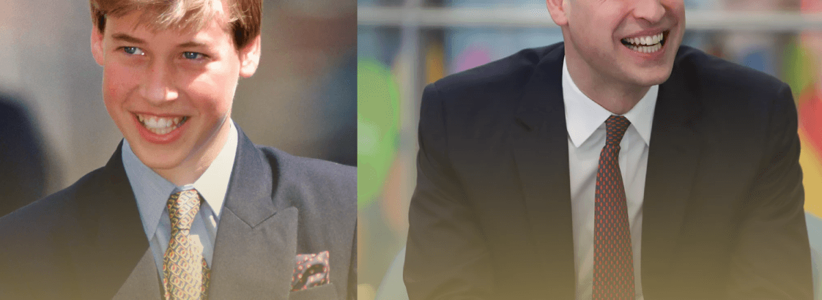 Prince William’s Hair Loss